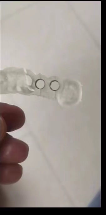 Resin Dental 3D Printer Planti - огляд і ціна 3D Printing Uv Resin